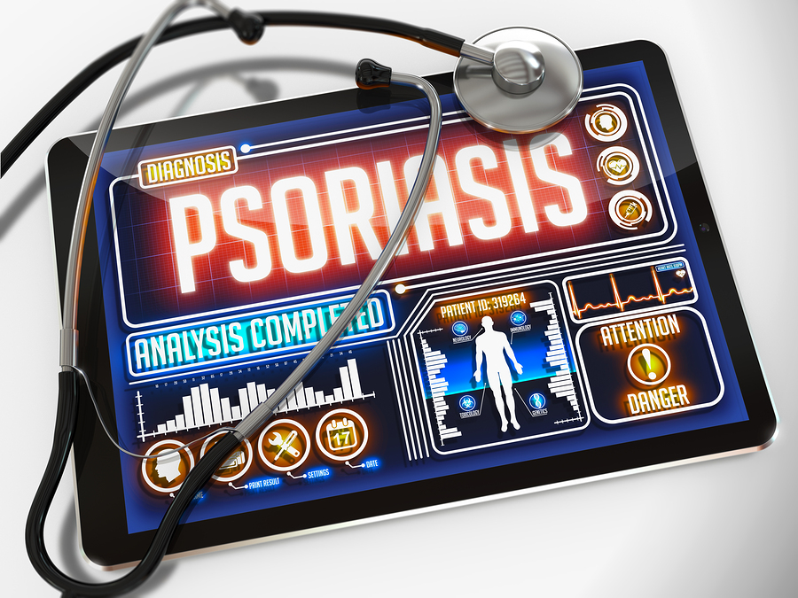 psoriasis dermatólogos