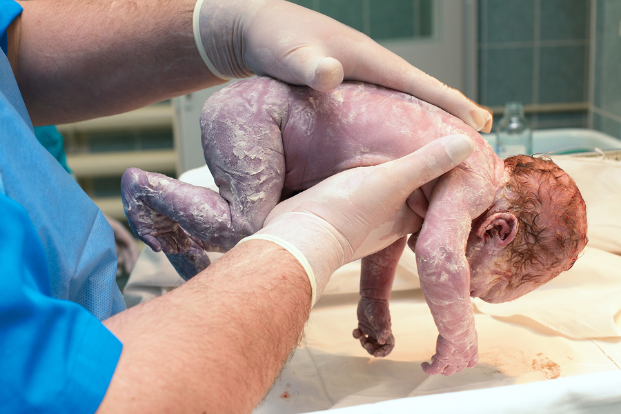 Recien-Nacido-Neonato-Cesarea-Natural