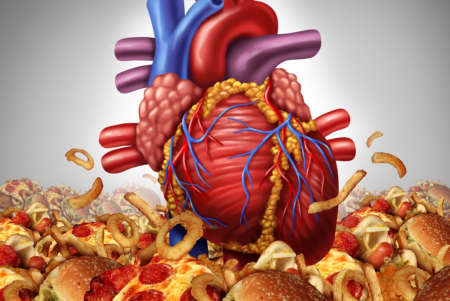 Insuficiencia-Cardiaca-Sobrepeso-Obesidad