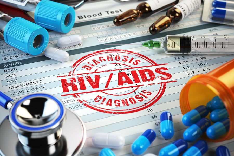 VIH-Sida-HIV-AIDS-Diagnostico