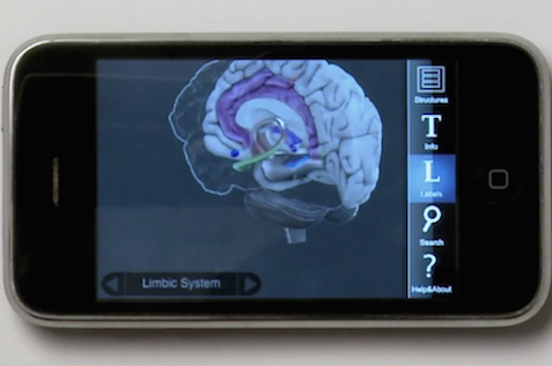 3D-Brain-Fisiologia-Lesiones-Cerebrales