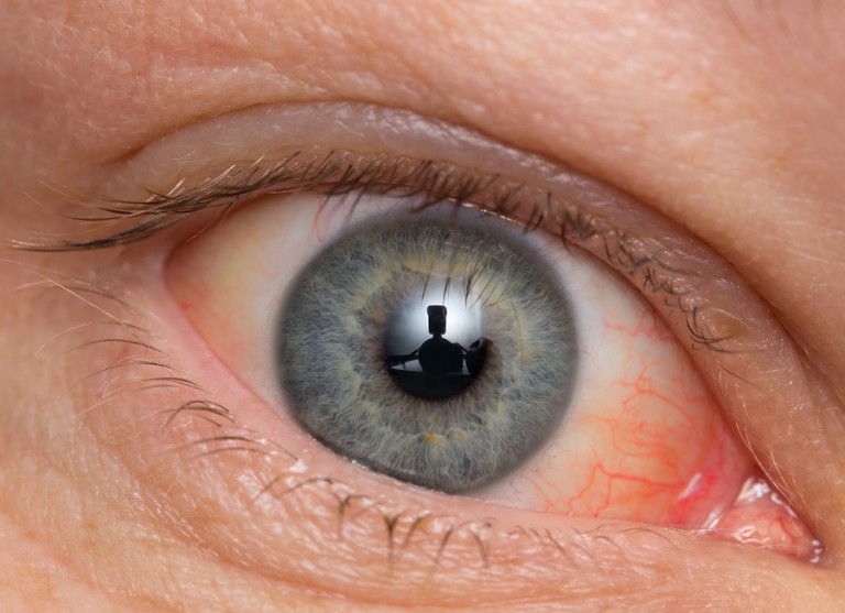 Médicos de EE.UU. identifican 10 tumores en el ojo de una paciente