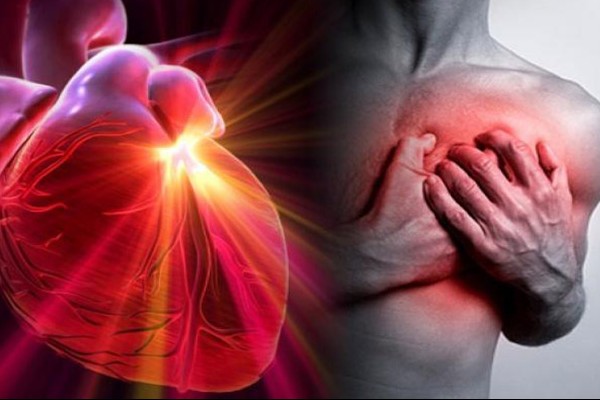 Cuida tu Corazón prevenir infartos